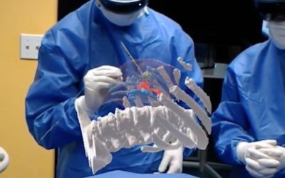 MediView XR Raises $4.5 Million To Give Surgeons X-Ray Vision With AR
